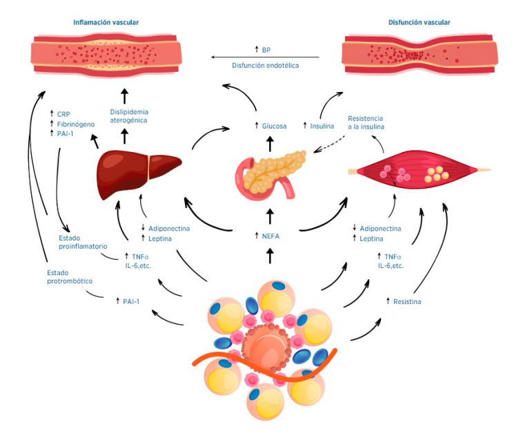 Obesidad, Inflamación E Inmunidad ¿qué Relación Hay? - Blog Un Vaso De ...