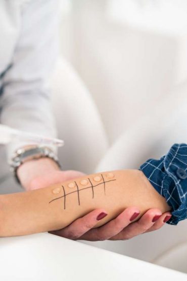 Vitamina D y alergias infantiles